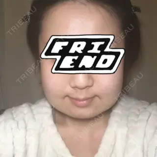4日目の経過画像（1枚目）