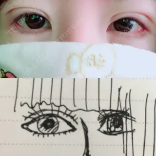 15日目の経過画像（1枚目）
