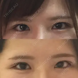 89日目の経過画像（1枚目）