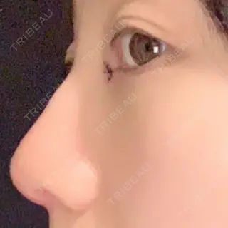 3日目の経過画像（3枚目）