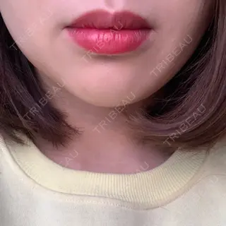 1日目の経過画像（1枚目）