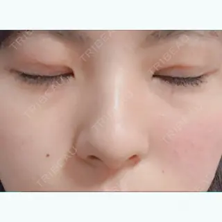 8日目の経過画像（2枚目）