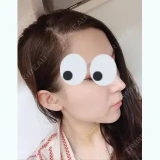 9日目の経過画像（1枚目）