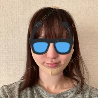 0日目の経過画像（1枚目）