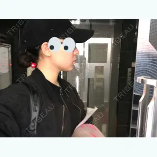 9日目の経過画像（2枚目）