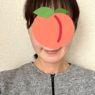 1日目の経過画像（1枚目）