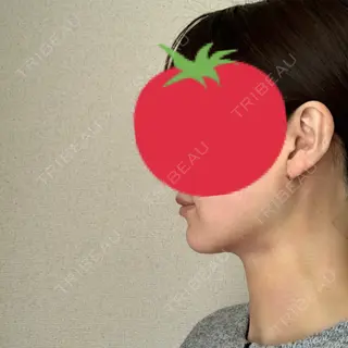 1日目の経過画像（2枚目）
