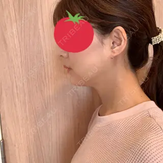 2日目の経過画像（2枚目）