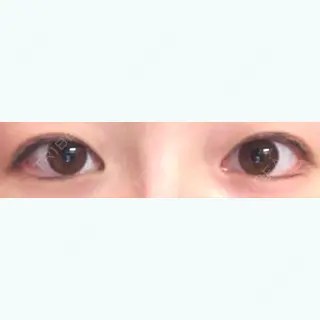 30日目の経過画像（1枚目）