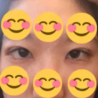 2日目の経過画像（2枚目）