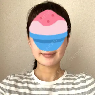 2日目の経過画像（1枚目）