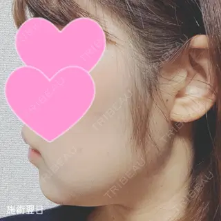 1日目の経過画像（2枚目）