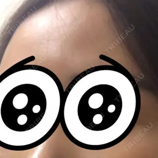 299日目の経過画像（1枚目）