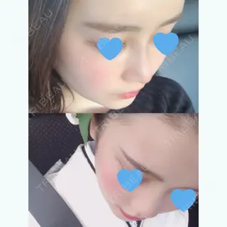 20日目の経過画像（2枚目）