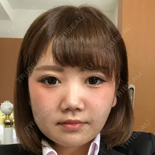 10日目の経過画像（1枚目）