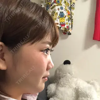 10日目の経過画像（2枚目）