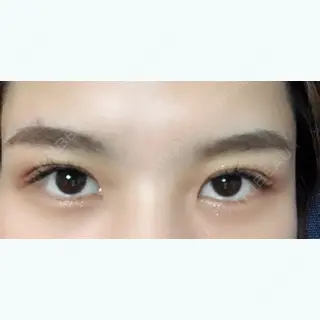 55日目の経過画像（2枚目）