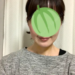 4日目の経過画像（1枚目）
