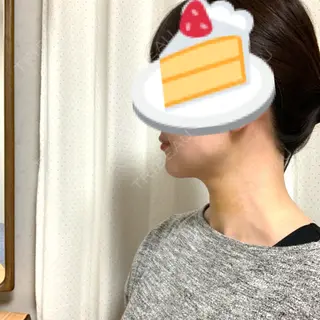 4日目の経過画像（2枚目）