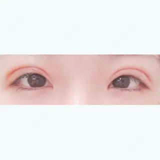 8日目の経過画像（1枚目）