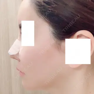 5日目の経過画像（1枚目）