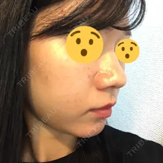 9日目の経過画像（2枚目）