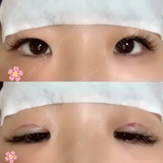 0日目の経過画像（1枚目）