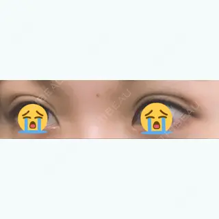 4日目の経過画像（1枚目）