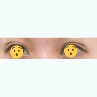 295日目の経過画像（1枚目）