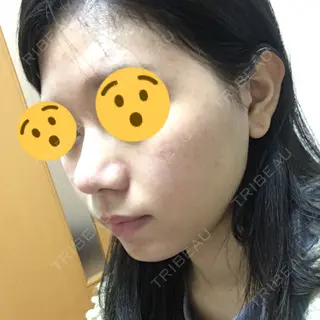 10日目の経過画像（2枚目）