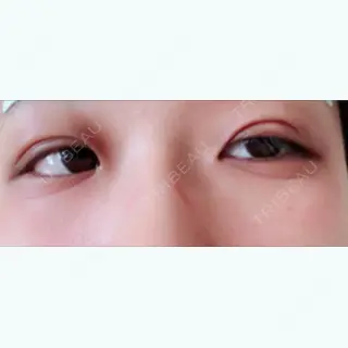 1日目の経過画像（1枚目）