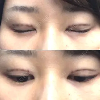 0日目の経過画像（2枚目）