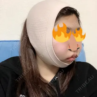 1日目の経過画像（2枚目）