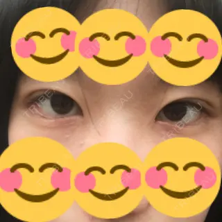 8日目の経過画像（2枚目）