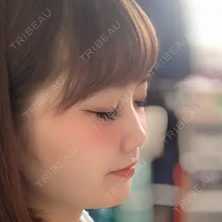 13日目の経過画像（3枚目）