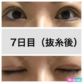 7日目の経過画像（1枚目）