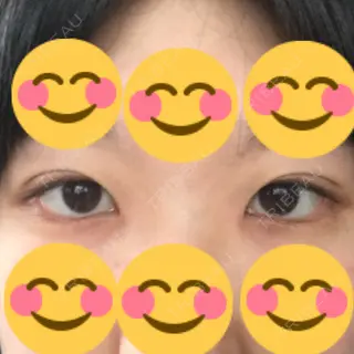 9日目の経過画像（2枚目）
