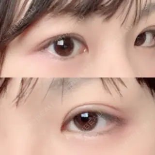 53日目の経過画像（2枚目）