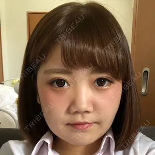 15日目の経過画像（1枚目）