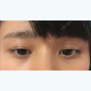 208日目の経過画像（2枚目）