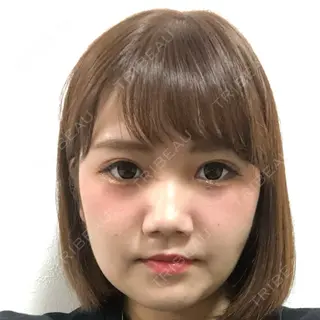 15日目の経過画像（1枚目）
