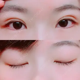19日目の経過画像（1枚目）