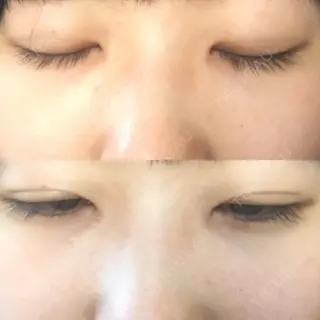 10日目の経過画像（1枚目）