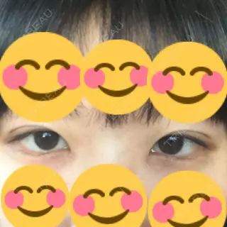10日目の経過画像（2枚目）