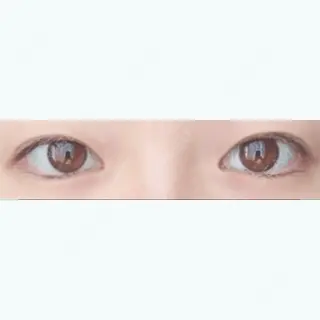 39日目の経過画像（1枚目）