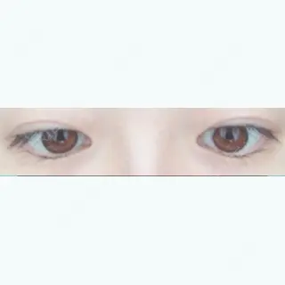 39日目の経過画像（2枚目）