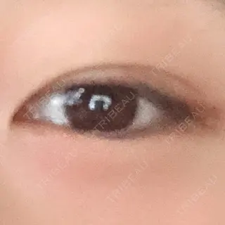 27日目の経過画像（1枚目）