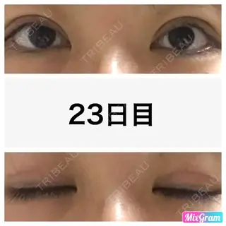 23日目の経過画像（1枚目）