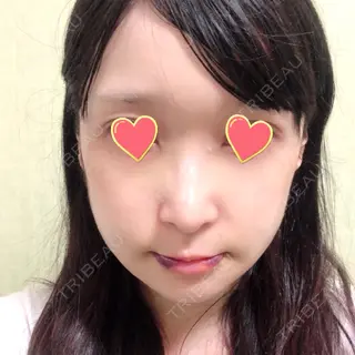 3日目の経過画像（1枚目）