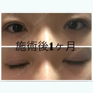 31日目の経過画像（1枚目）